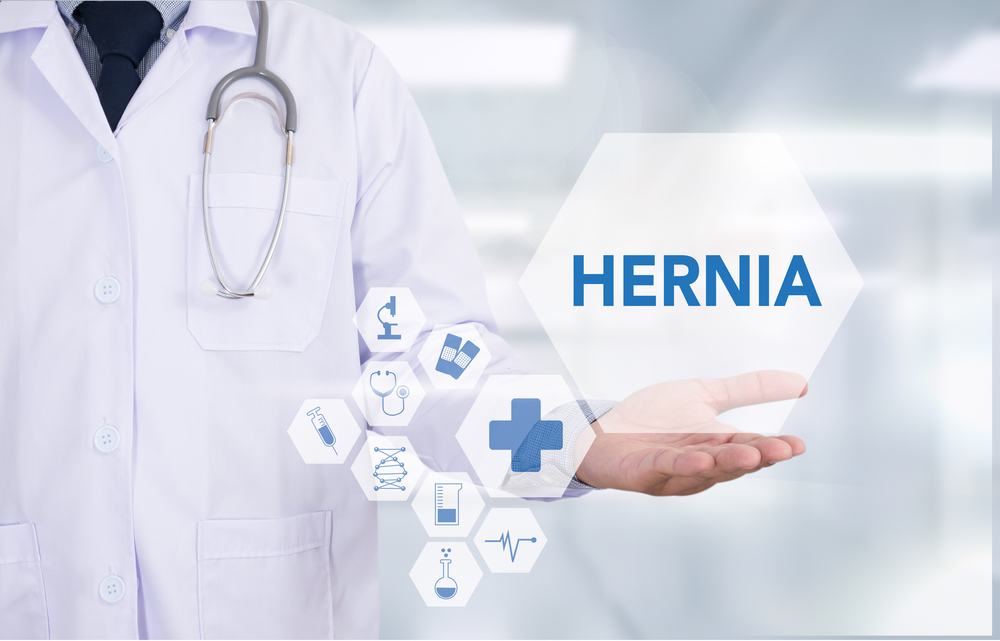 O que é Hérnia no Umbigo? causas e tratamento - Hernia Clinic