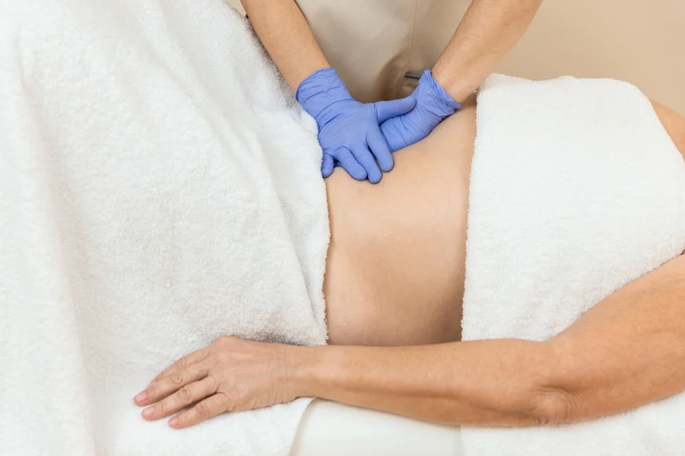 Tratamento da diástase dos retos