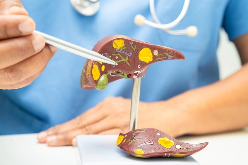 Pós-operatório da cirurgia de pedra na vesícula