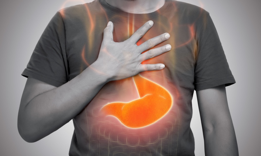 Refluxo gastroesofágico: sintomas e opções de tratamento