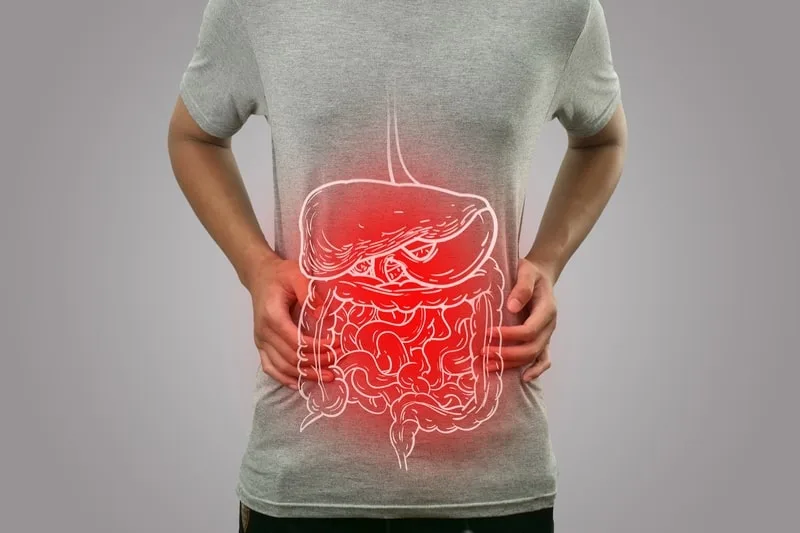 Fístula intestinal: o que é, sintomas e como tratar