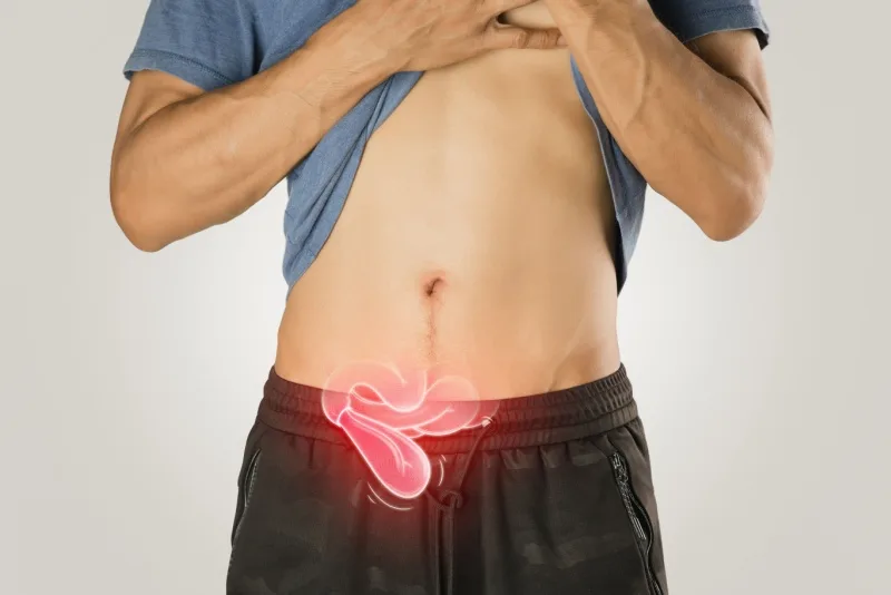 O que é herniorrafia? Indicações, tipos e cuidados