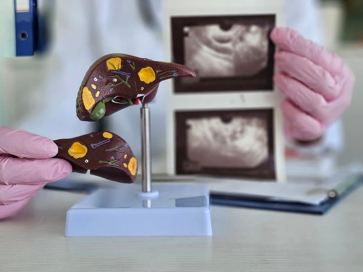 Cirurgia para câncer de fígado: quando é indicada e como funciona