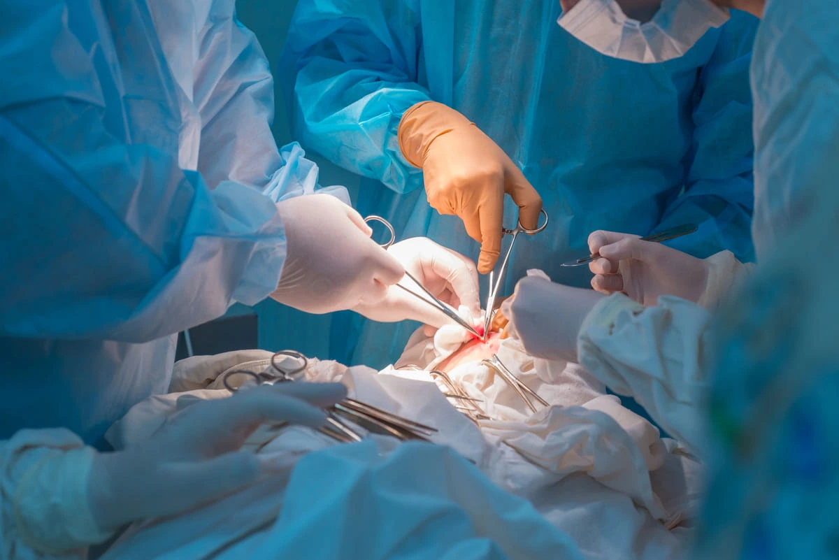 Cirurgia para hérnia recidivada: como é feito o tratamento quando a hérnia volta